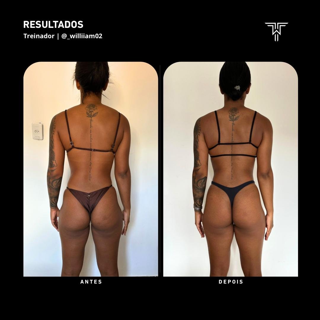 Antes e depois feminino — glúteo com treino direcionado Team William